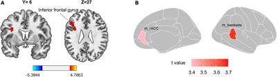 Identifying the neural marker of chronic sciatica using multimodal neuroimaging and machine learning analyses